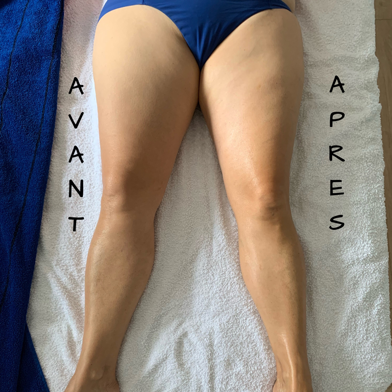 avant-apres-template2